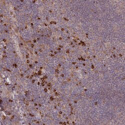 MPG1 Antibody, Novus Biologicals:Antibodies:Primary Antibodies